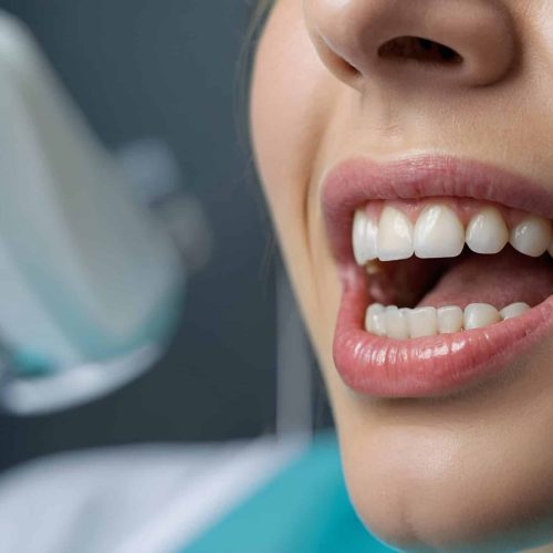 dentist-8729628 dentist-8729628